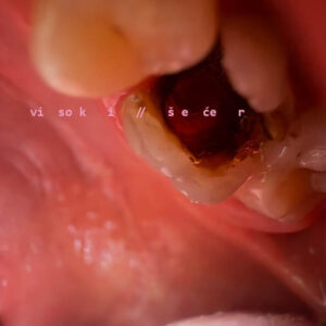 high sugar exhibition that is part of Cherry Pop Festival